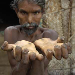Indien 17