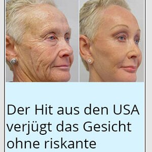 Falten_Anzeige.jpg