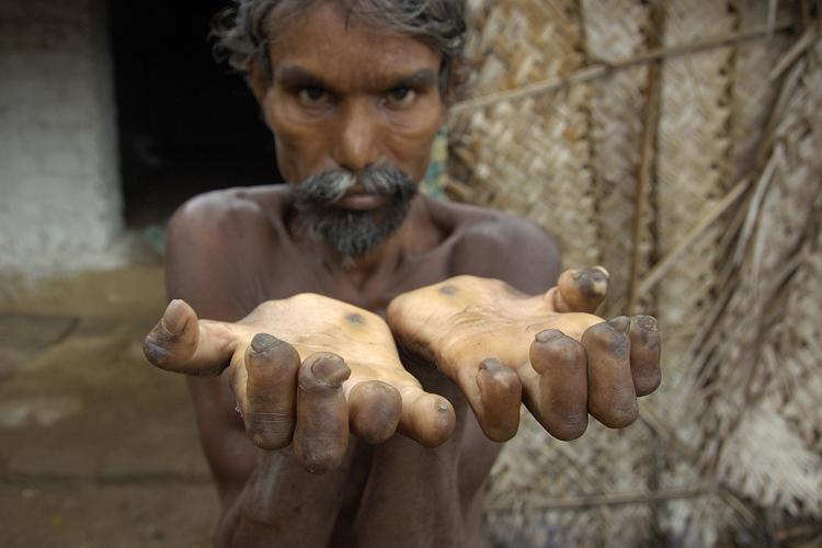 Indien 17