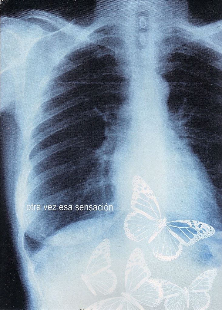 otra vez esa sensacion