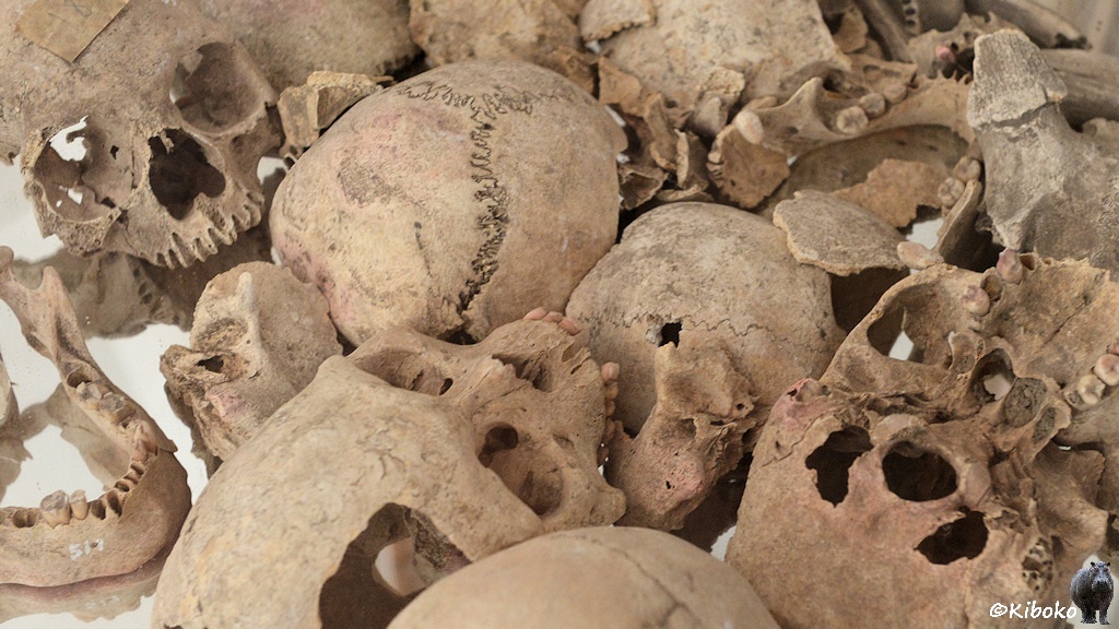 Das Bild zeigt eine Sammlung von durcheinanderliegenden Schädeln. Teilweise sind die Schädel in Teile gesplittert und wieder zusammengenäht.